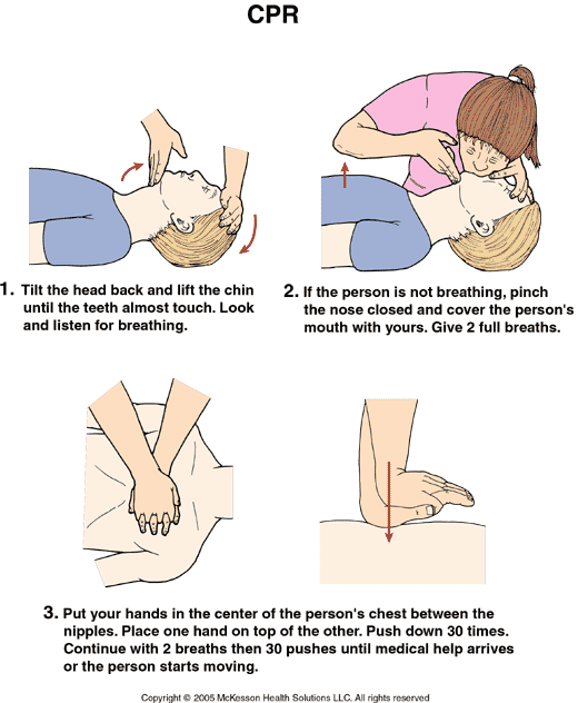 CPR: Illustration