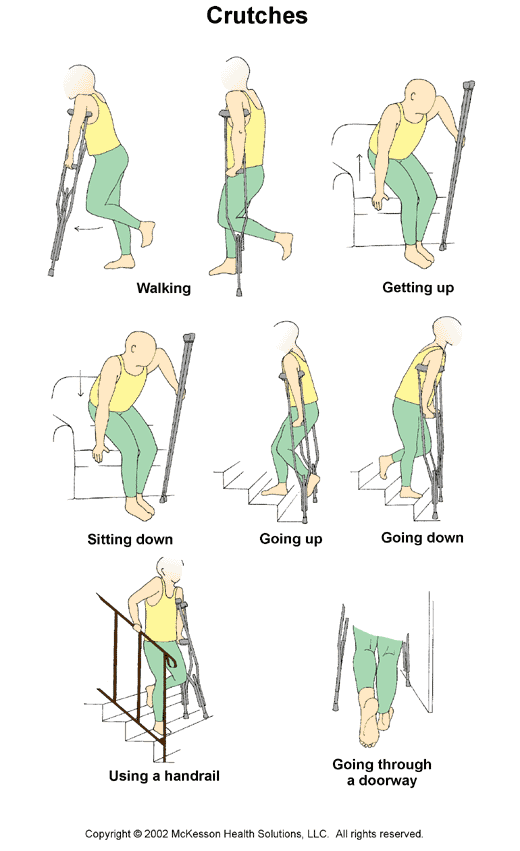Crutches: Illustration