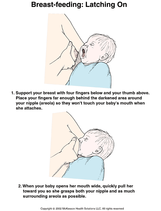 Breast-Feeding, Latching on: Illustration