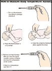 Thumbnail image of: How to Measure Body Temperature, Axillary: Illustration