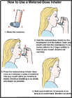 Thumbnail image of: How to Use a Metered-Dose Inhaler: Illustration